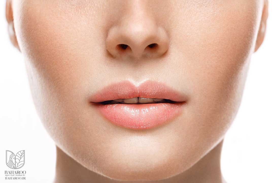 تزریق ژل لب نچرال در کرج - مرکز زیبایی بهارو