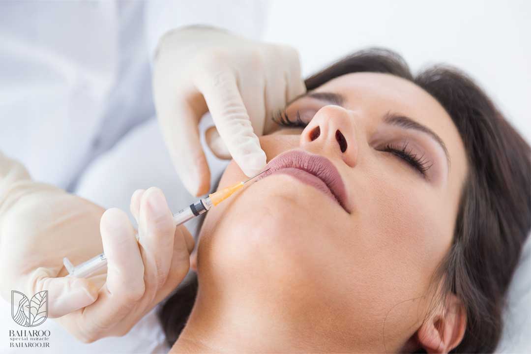 تزریق ژل لب نچرال در کرج - مرکز زیبایی بهارو